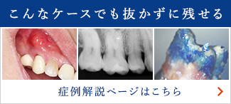 こんなケースでも抜かずに残せる