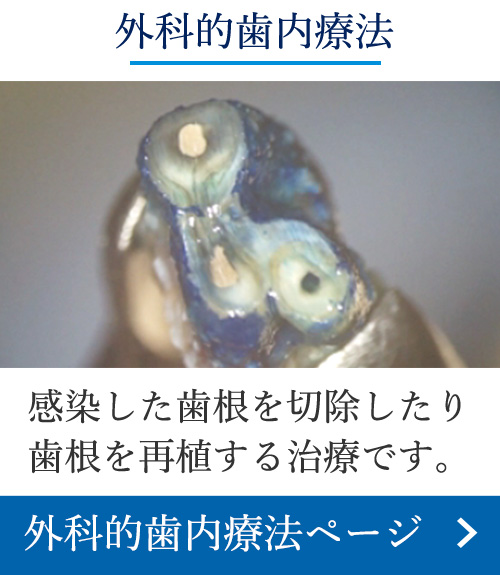 歯内療法wikipedia｜岡山の歯科｜正しい根管治療で歯を抜かない